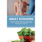 Adult Scoliosis: A Beginner's 2-Week Quick Start Guide on Managing Adult Scoliosis Through Diet and Other Natural Methods, With Sample Recipes and a M