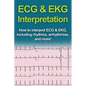 ECG & EKG Interpretation: How to interpret ECG & EKG, including rhythms, arrhythmias, and more!